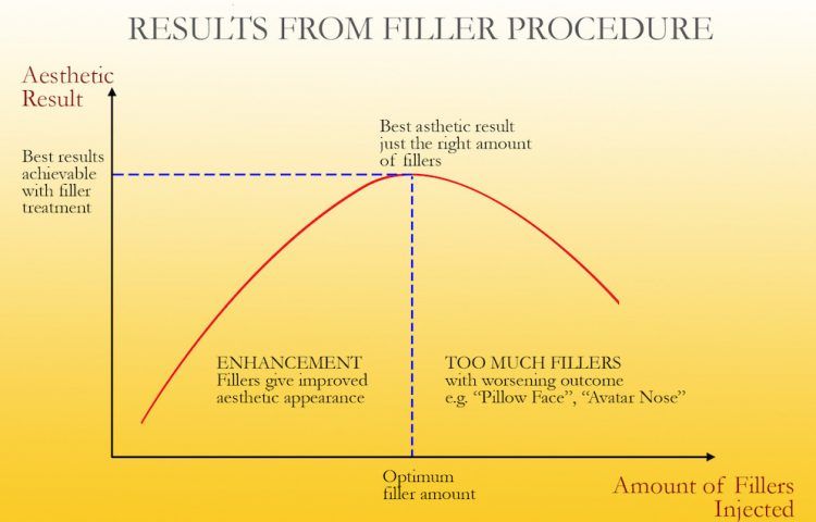 Filler Result Chart